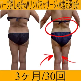 YOSAPARK MANAのエステ・リラクイメージ