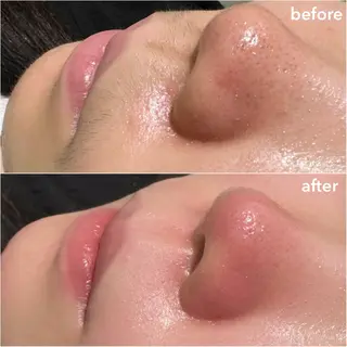 REVE （レーヴ）のマツエク・マツパデザイン