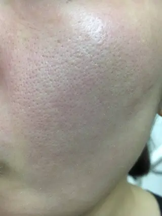 ビューティハウスRoca所属・ビューティハウスロカ 桑原菜帆のエステ・リラクイメージ