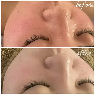 メンズ メナード岐阜茜部 杉浦のエステ・リラクイメージ