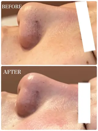 GULLIG söt GULLIGのネイルデザイン