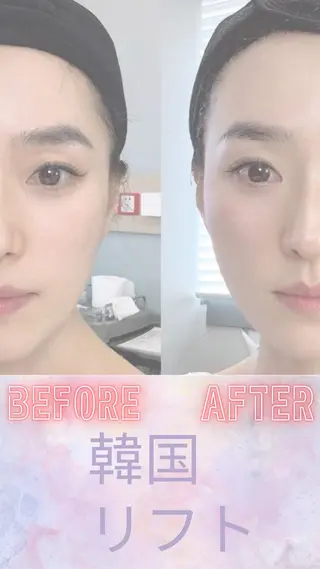 ショート 愛維美水光美肌専門店所属・愛維美水光美肌専門店 メンズレディースokのエステ・リラクイメージ