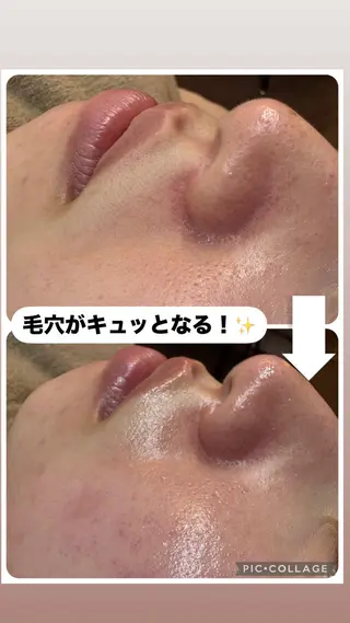 W MISATOのエステ・リラクイメージ