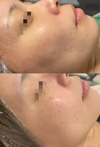 シミケア専門店モルセラ所属・シミケア専門店 モルセラのエステ・リラクイメージ