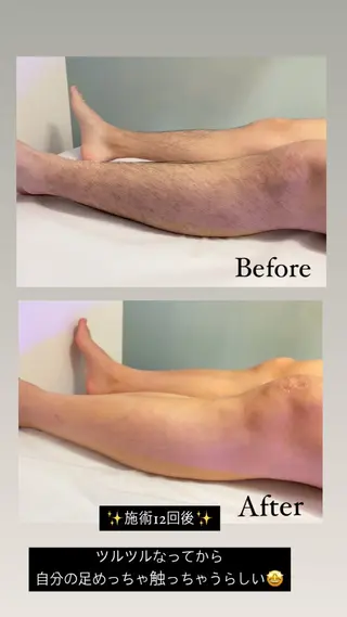 I'iris所属・【脱毛サロン iiris】占い可のエステ・リラクイメージ