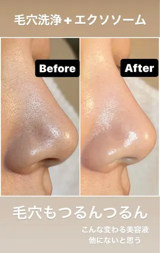 新井 ゆかのエステ・リラクイメージ