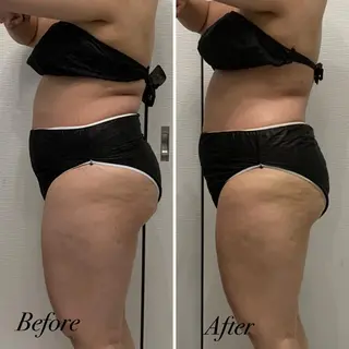 R.M所属・プライベートサロン R.Mのエステ・リラクイメージ