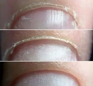 ネイル MMNail Salon所属・イパラギレ ミラグロスのネイルデザイン