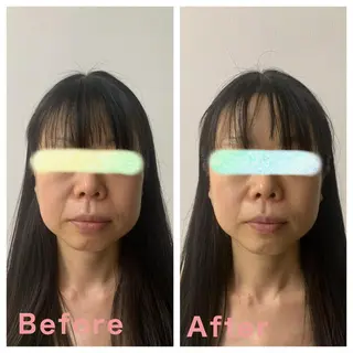 ボディ&フェイシャルサロン Vierouge所属・肌質改善・美肌サロン ヴィエルージュのエステ・リラクイメージ