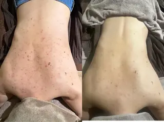 エミルカ　自由が丘店所属・花島 悠のエステ・リラクイメージ