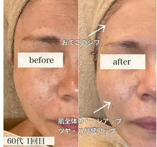 BeautySalon　heart所属・Beauty Salonheartのエステ・リラクイメージ