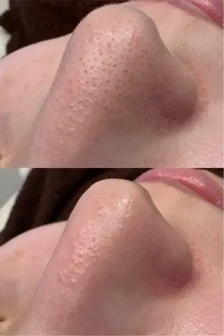 岩田 里央のエステ・リラクイメージ