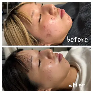 Ruby池袋所属・医療提携Ruby  大瀧のその他イメージ