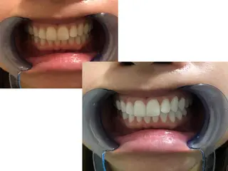 ミディアム ヘアアレンジ ネイル カラー メンズ マツエク・マツパ パーマ キッズ アイブロウ 中目黒 ホワイトニングサロンのその他イメージ