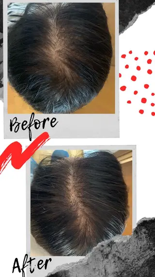 ミディアム ヘアアレンジ Kanal Kanaのエステ・リラクイメージ