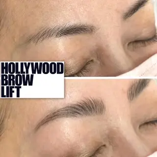 アイブロウ epismoo 脱毛/HBL/毛穴の眉毛・アイブロウイメージ