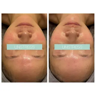 ☆痩身/小顔☆ 結果出します☆のエステ・リラクイメージ