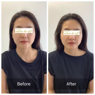 メディカルサロンドオフ所属・ハリサロンドオフ 美容鍼灸×小顔整体のエステ・リラクイメージ
