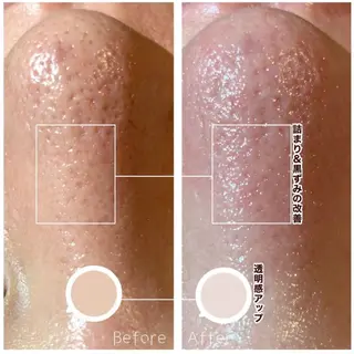 A.所属・Raviy(A.) 【痩身・韓国肌管理】のエステ・リラクイメージ