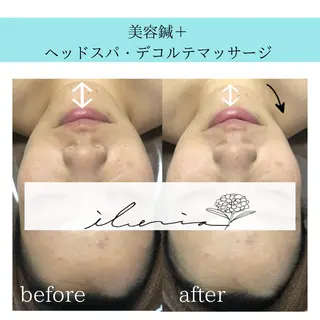 心斎橋痩身ダイエット 韓国.美容鍼.小顔のエステ・リラクイメージ