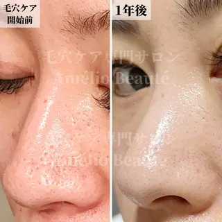 毛穴ケア専門サロン Amélio Beauté所属・毛穴ケア専門サロン アメリオボーテのその他イメージ
