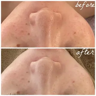 メンズ メナード岐阜市茜部 杉浦のエステ・リラクイメージ