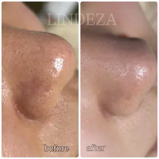 private salon 𝐋𝐈𝐍𝐃𝐄𝐙𝐀所属・LINDEZA Ayaのエステ・リラクイメージ