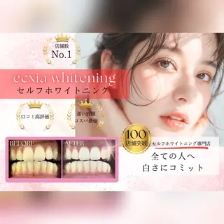 エクシアホワイトニング所属・よなな エクシア盛岡中央通店のエステ・リラクイメージ