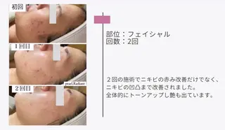 艶肌ワックス ALLY.のエステ・リラクイメージ