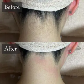 脱毛専門サロン BELFINE恵比寿のエステ・リラクイメージ