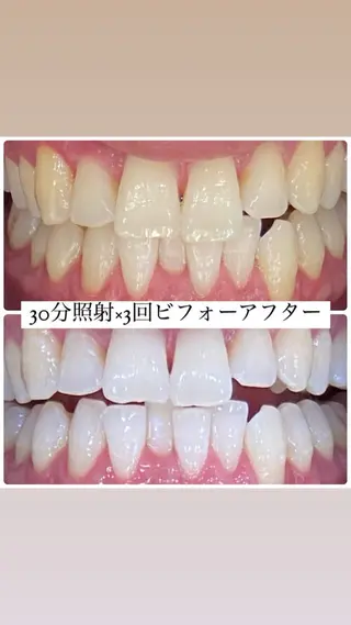 メンズ ホワイトニングルーム　川崎店所属・ホワイトニング ルーム　川崎店のその他イメージ