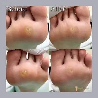 巻き爪補正店 大阪天王寺店のネイルデザイン