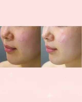 【エイジングケア肌質改善フェイシャル専門】Thanq-サンク-所属・サンク 飯田（イイダ）のエステ・リラクイメージ