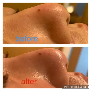 エステティックサロンアトリエホミィ所属・エステティックサロン アトリエ　ホミィのエステ・リラクイメージ