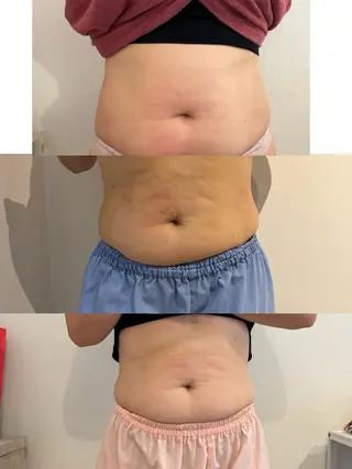 メンズ 腸活サポート みなみののエステ・リラクイメージ