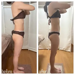 biloop所属・《痩身×疲労改善》 BILOOPのエステ・リラクイメージ