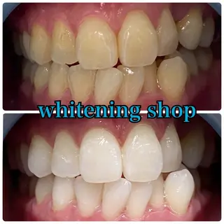 メンズ ホワイトニング ショップ川越店のエステ・リラクイメージ