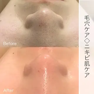 脱毛&ビューティー A'nJUDYの眉毛・アイブロウイメージ