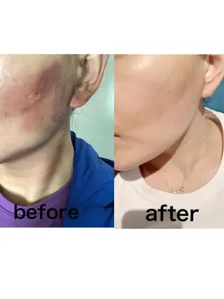 エステサロンvivi 脱毛・エステ・まつ毛のその他イメージ