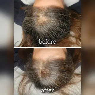 ヘアアレンジ 歯科提携セルフダック 宇都宮駒生店のエステ・リラクイメージ