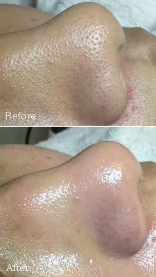 エステサロン Lazulisea所属・川口 春奈のエステ・リラクイメージ