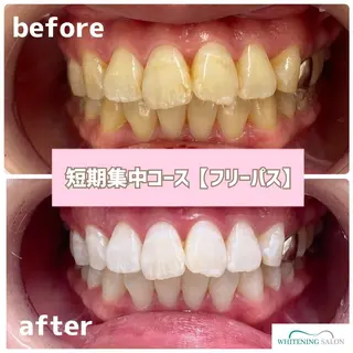 メンズ ホワイトニングサロン BE WHITE金山のその他イメージ