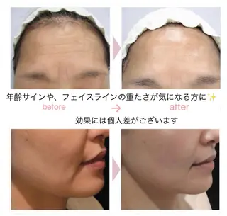 Binosu所属・エンダモロジー BINOSUのエステ・リラクイメージ