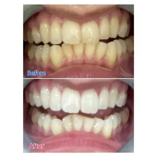 MBEAUTYSALON 千葉店・京成大久保所属・Melty 輝のその他イメージ