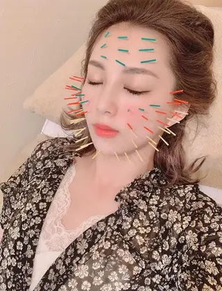 鍼灸整骨院Refine所属・鍼灸 Refineのその他イメージ