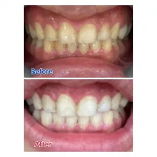 M渋谷店所属・Ｍ渋谷 ホワイトニングのエステ・リラクイメージ