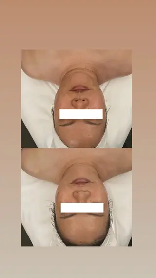 ナリスビューティステーション デアイム宇治大久保所属・お肌と向き合うエステ |貞本恵のエステ・リラクイメージ