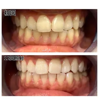 セルフホワイトニング　アデル所属・戸嶋 菫のエステ・リラクイメージ