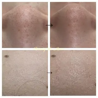 ビューティー ミロワールのエステ・リラクイメージ