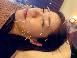 Acupuncture  salon LINOA リノア鍼灸院所属・ヘッドスパ鍼/小顔鍼 耳ツボ 　LINOAのエステ・リラクイメージ